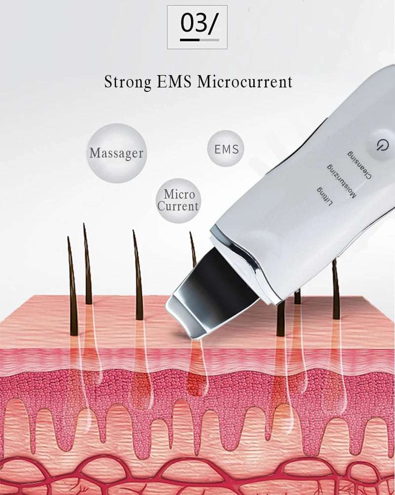 Ultrasonic Skin Scrubber – Professional Pore Cleaner & Blackhead Remover | Deep Facial Cleansing Device for Home Use